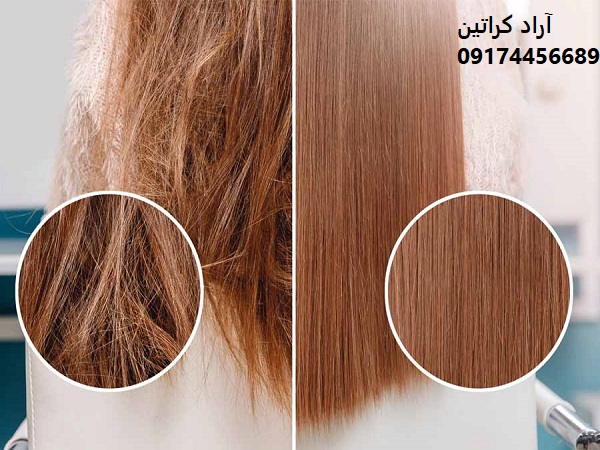 طلا تراپی مو|احیا و بازسازی مو های آسیب دیده